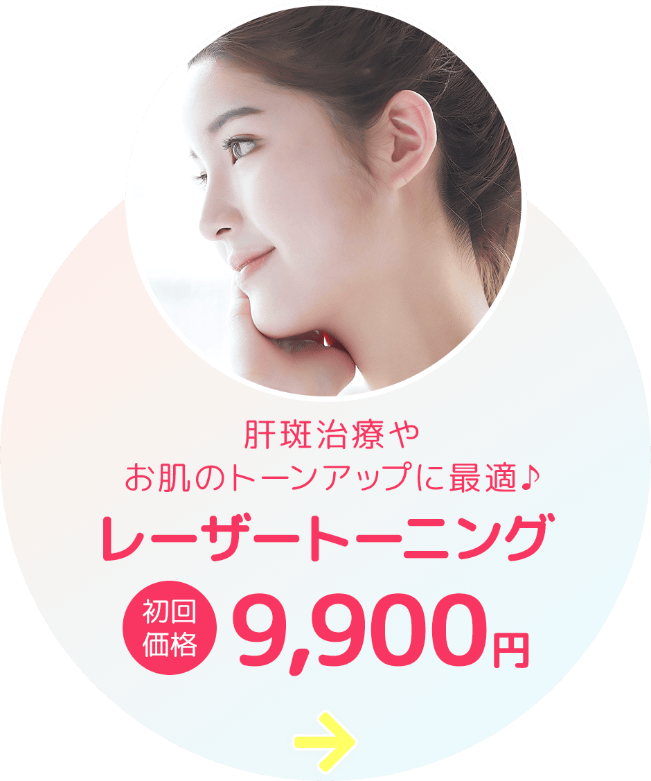 レーザートーニング