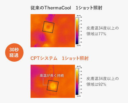 照射後の温度の比較